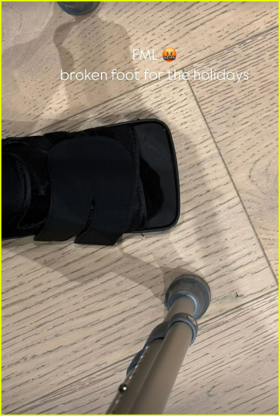 Kim Kardashian Reveals She Broke Her Foot, Shares a Photograph | Kim Kardashian | Simply Jared: Superstar Information and Gossip