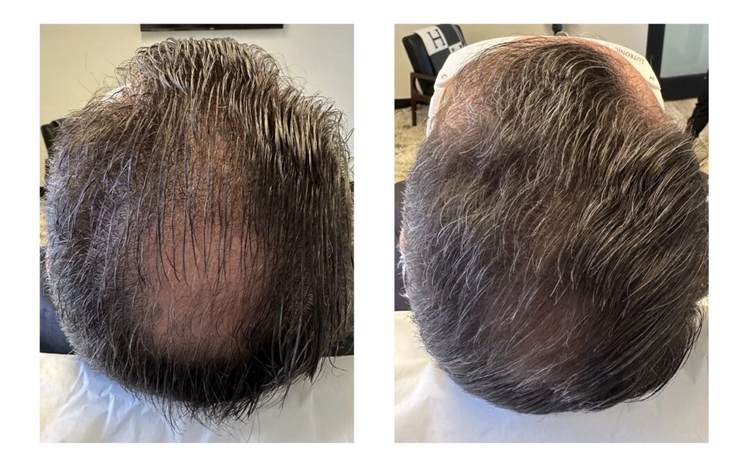 The Science of Scalp Health
