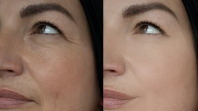 7 Offers on Underneath-Eye Remedies to Look 10 Years Youthful